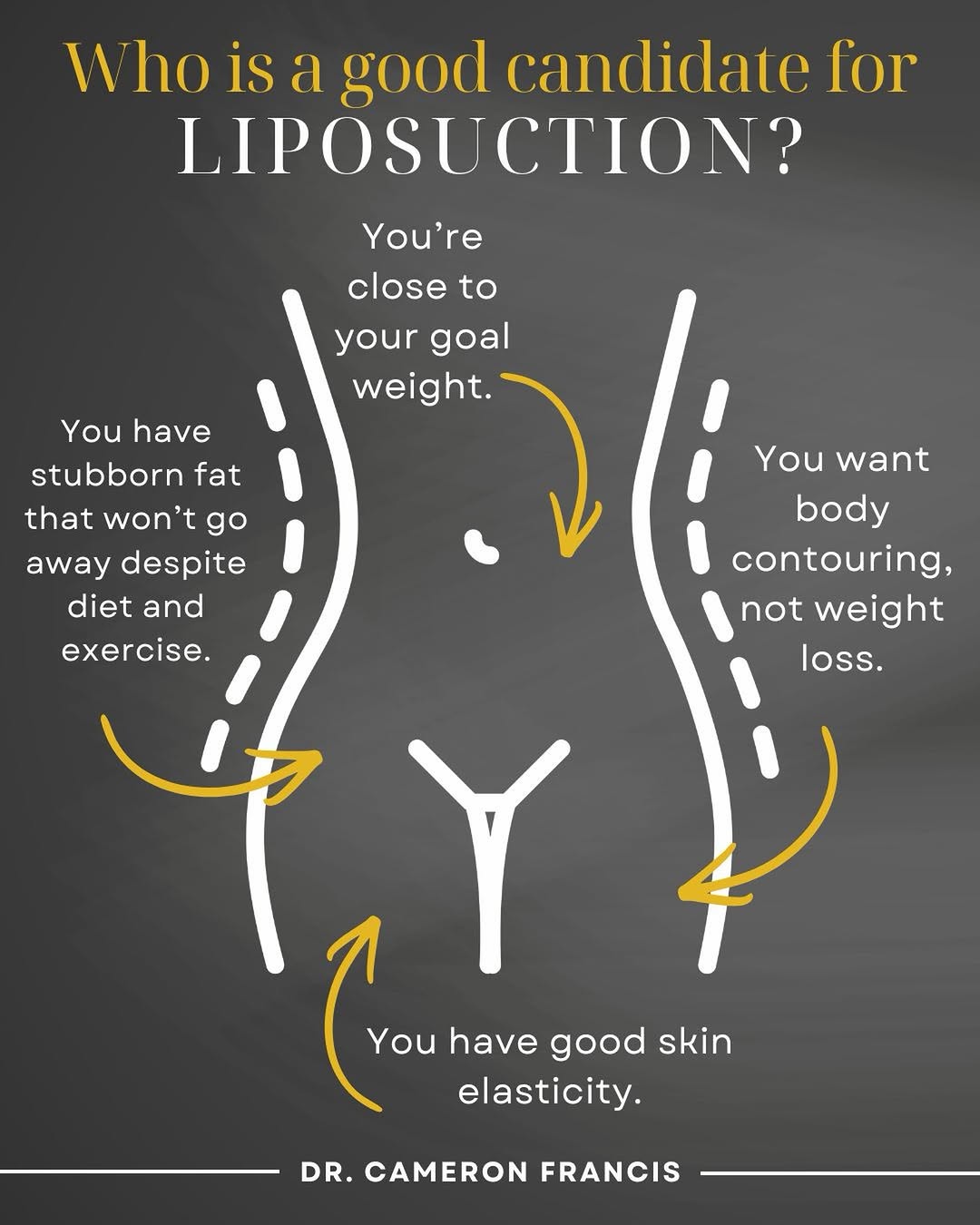 Instagram post by Dr. Cameron S. Francis: Who is a good candidate for liposuction? ✨ ▪️You’re close to your goal weight. ▪️You have good skin elasticity. ▪️You want body contouring, …