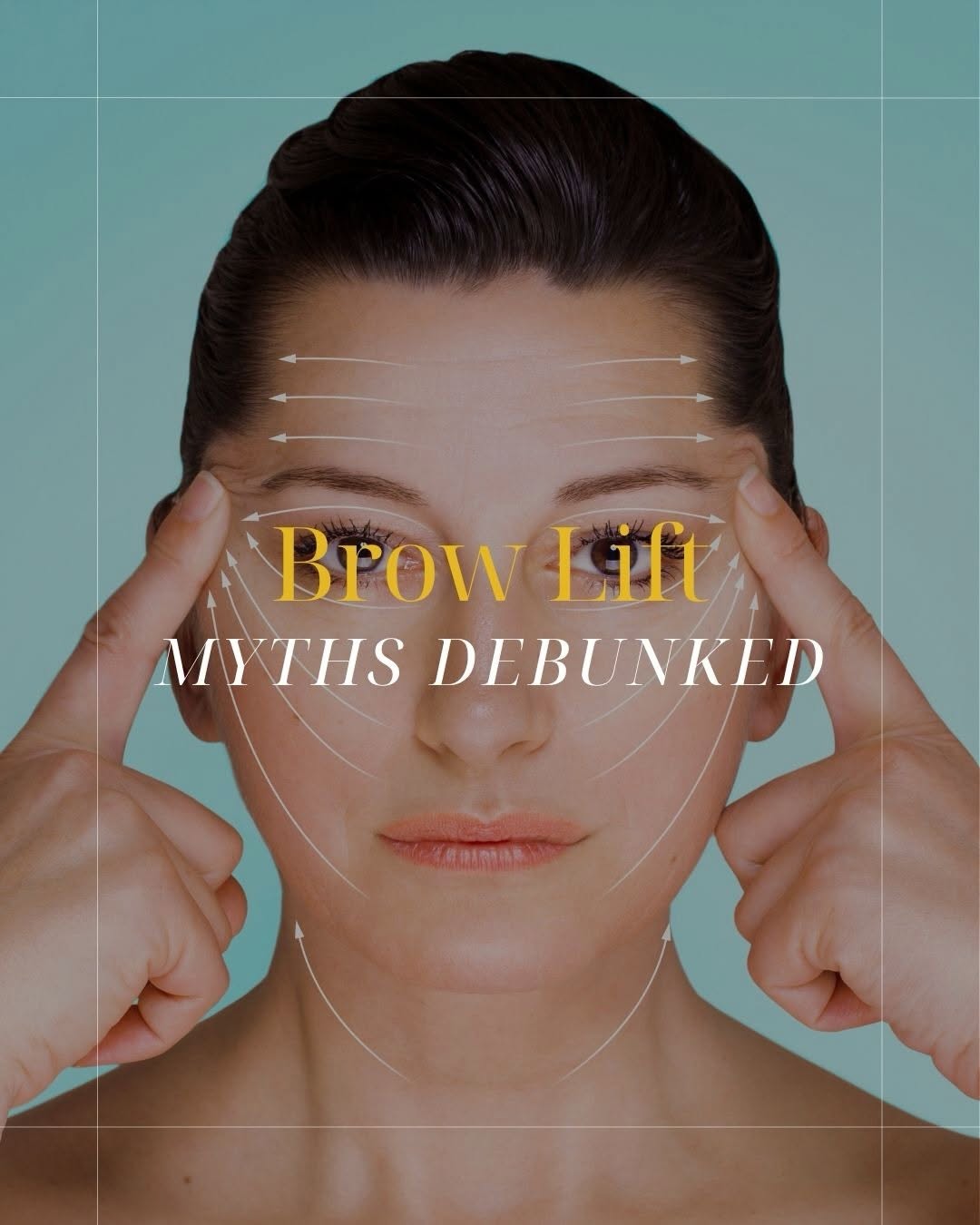 Instagram post by Dr. Cameron S. Francis: Thinking about a brow lift? 🤔 Don’t let common myths keep you from learning the facts!