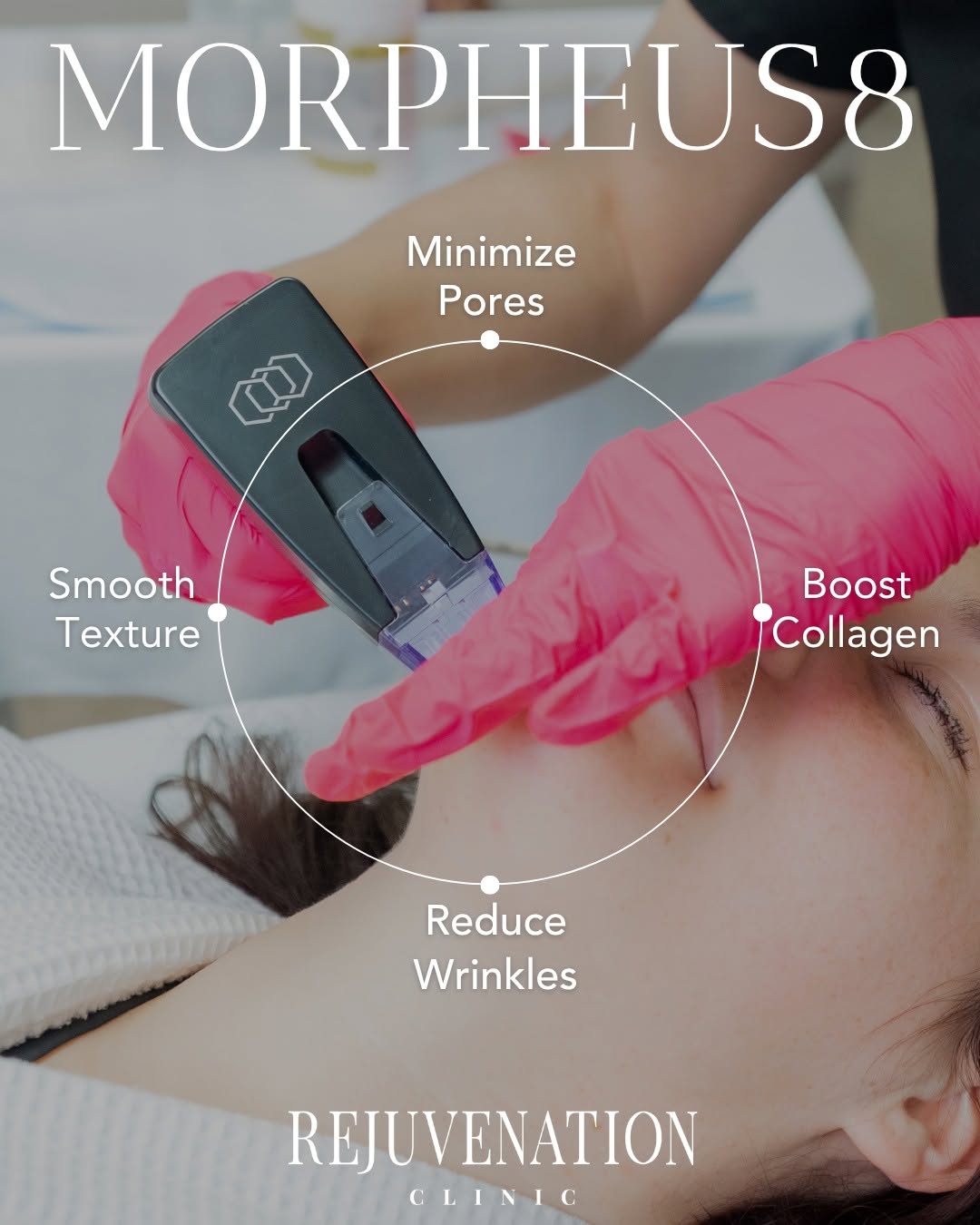 Instagram post by Dr. Carmela A. Pettigrew: In just 3 sessions, #Morpheus8 builds collagen, tightens skin, minimizes fine lines, improves the appearance of crow's feet, and reduces tex…