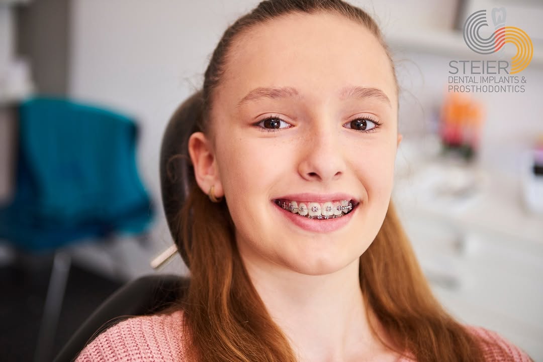 Instagram post by Dr. Carolina Steier, D: Spaced, crowded, and misaligned teeth need correction through orthodontic treatment. It improves the bite, places teeth in its proper positi…