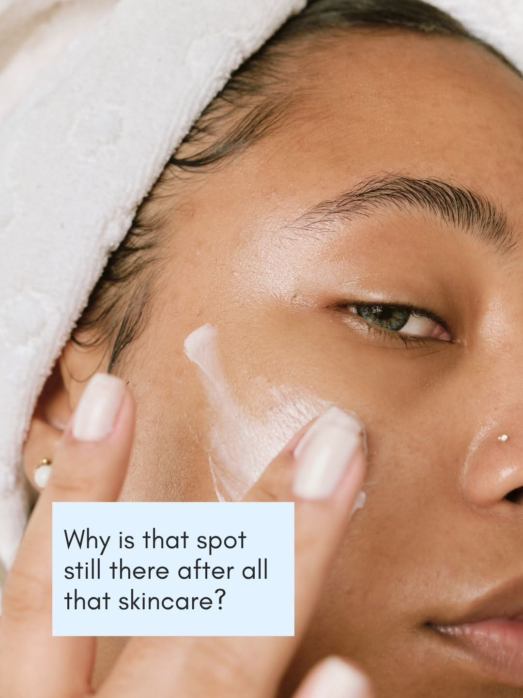 Instagram post by Dr. Carolyn Jacob: Still seeing brown spots and sun damage despite a good skincare routine? 👀 Fraxel® DUAL laser targets deeper discoloration, sun damage, une…