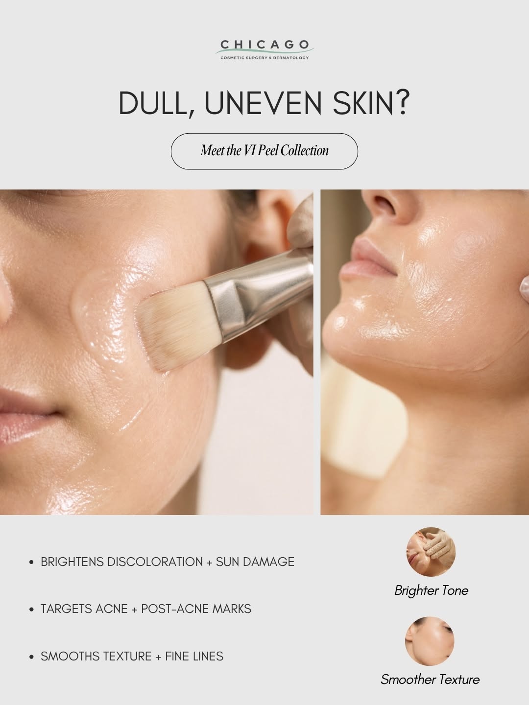 Instagram post by Dr. Carolyn Jacob: Not all chemical peels are created for the same skin concerns. Acne, discoloration, sun damage, texture, signs of aging. There’s a VI Peel d…