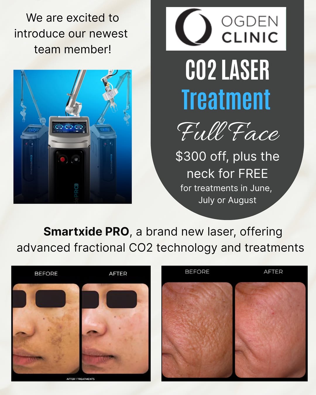 Instagram post by Dr. Chad Tingey: Introducing the Newest Addition to Our Aesthetics Team — the DEKA SmartXide PRO! We’re excited to offer advanced fractional CO2 laser techno…