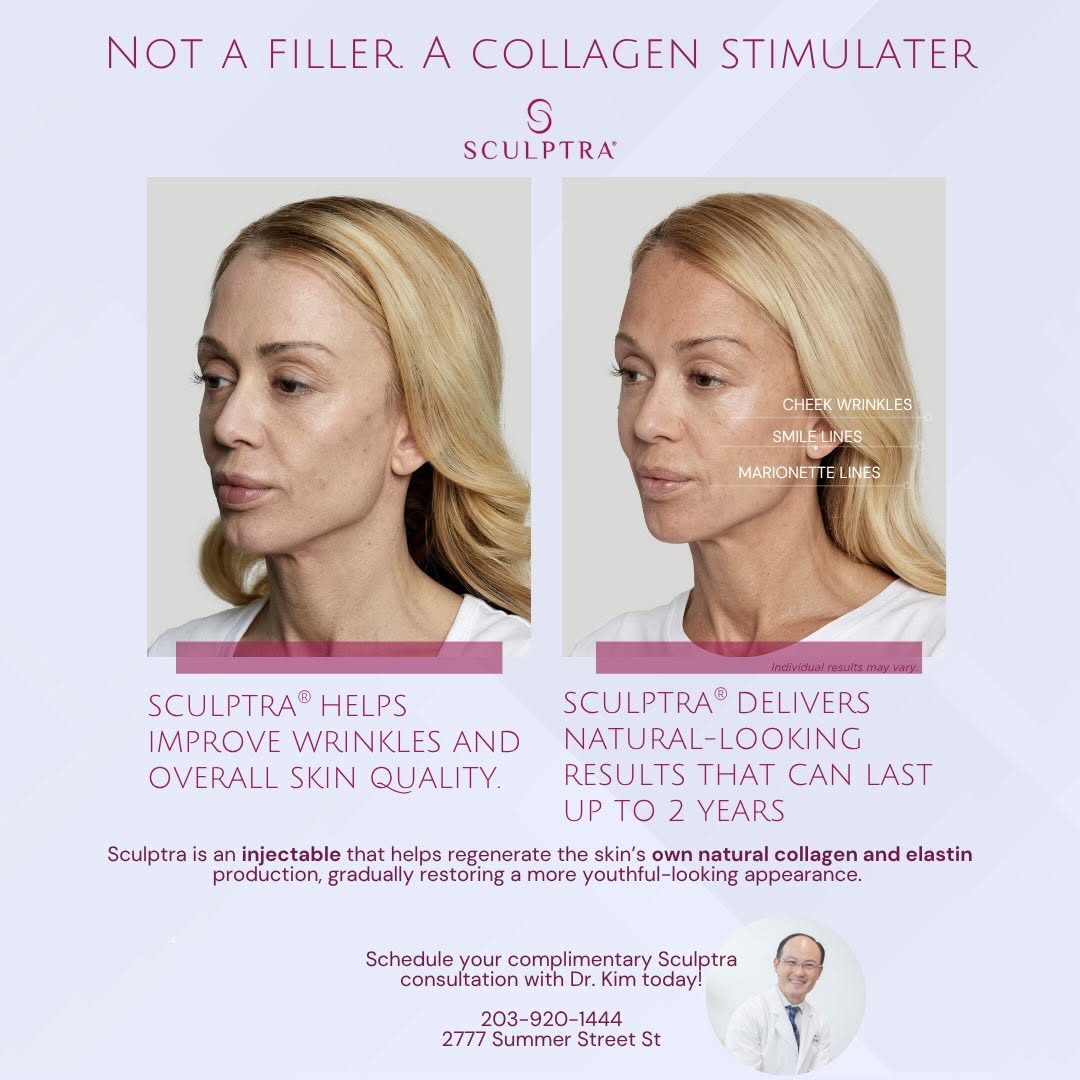 Instagram post by Dr. Chang Soo Kim: We’re not adding volume, we’re helping your skin rebuild its own collagen. Sculptra is a collagen stimulator designed to gradually restore f…