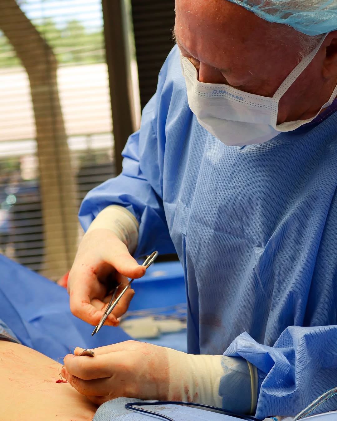 Instagram post by Dr. Charles A. Wallace: A tummy tuck is a very common surgery, so lets take a deeper look at it! 🔍 If you’re considering a tummy tuck, it’s important to know what …