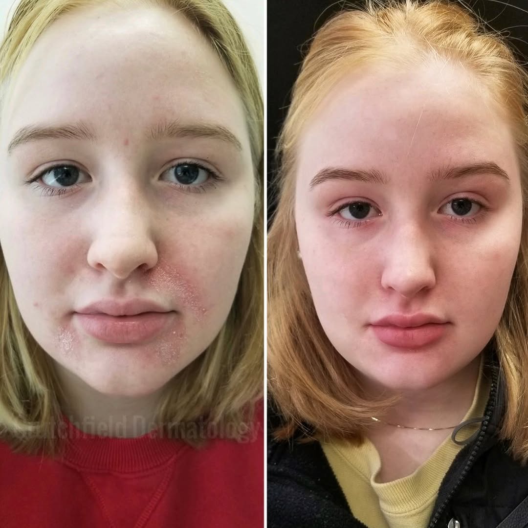 Instagram post by Dr. Charles E. Crutchfield III: Say goodbye to dry skin and redness this year with your own customized treatment plan Call 651-209-3600 to schedule #dryskin #dryskincare #f…