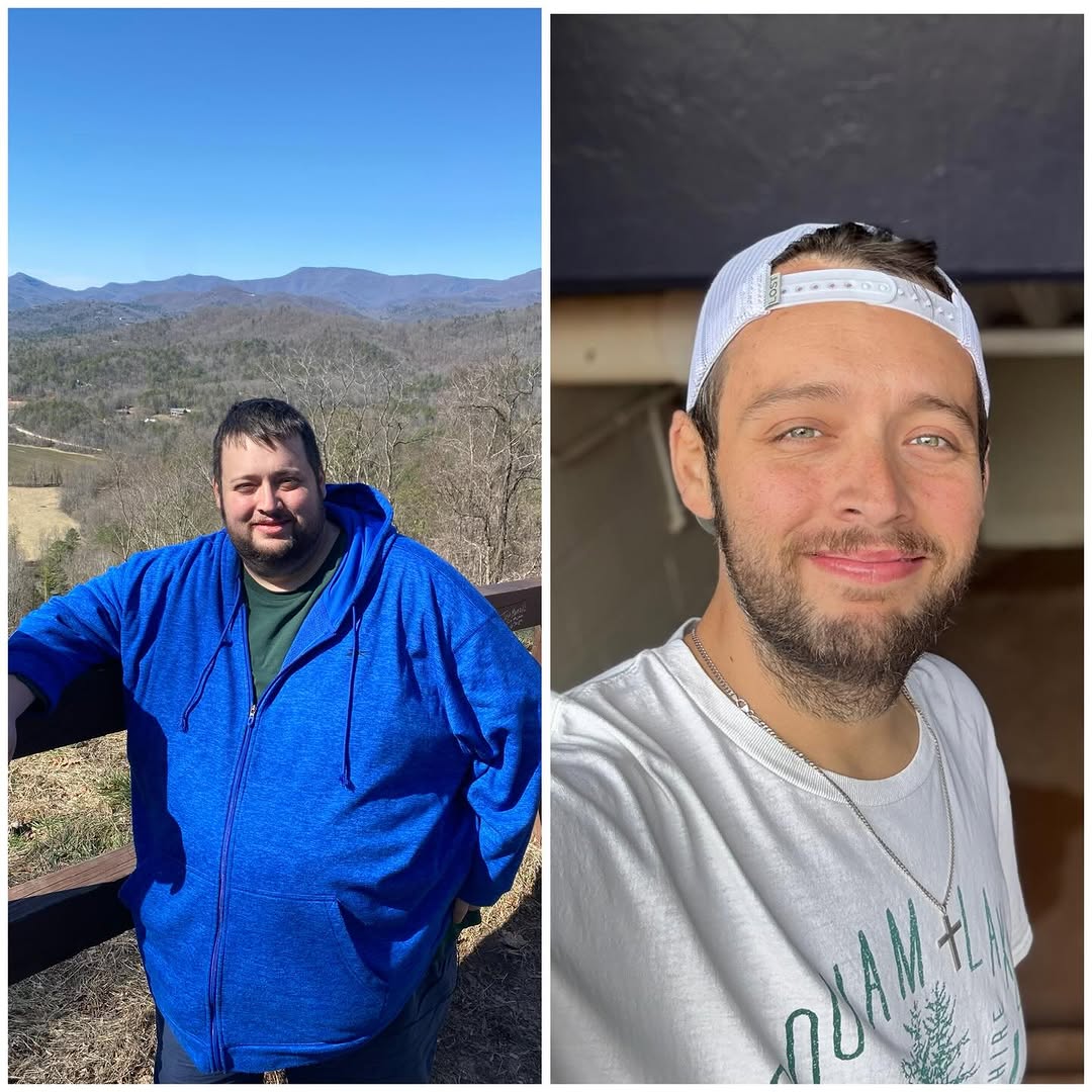 Instagram post by Dr. Charles Procter, Jr.: 🎉 Happy 2 Year Surgery-versary! 🎉 TWO YEARS AGO TODAY I stepped into a life changing moment and had bariatric surgery @northsidehosp If yo…