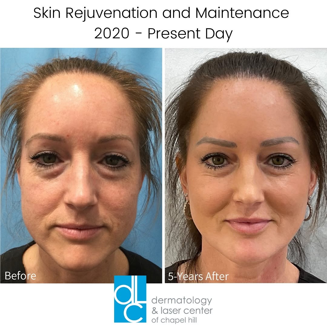Instagram post by Dr. Chris Adigun: Have you ever wondered how some people seem to defy the hands of time? With the right treatment plan, you might feel like you’re aging backw…
