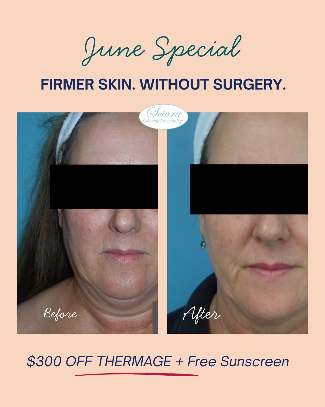 Instagram post by Dr. Christine Sciara: You may feel great on the inside, but when loose skin and loss of firmness start showing up in the mirror, it can affect your confidence in …