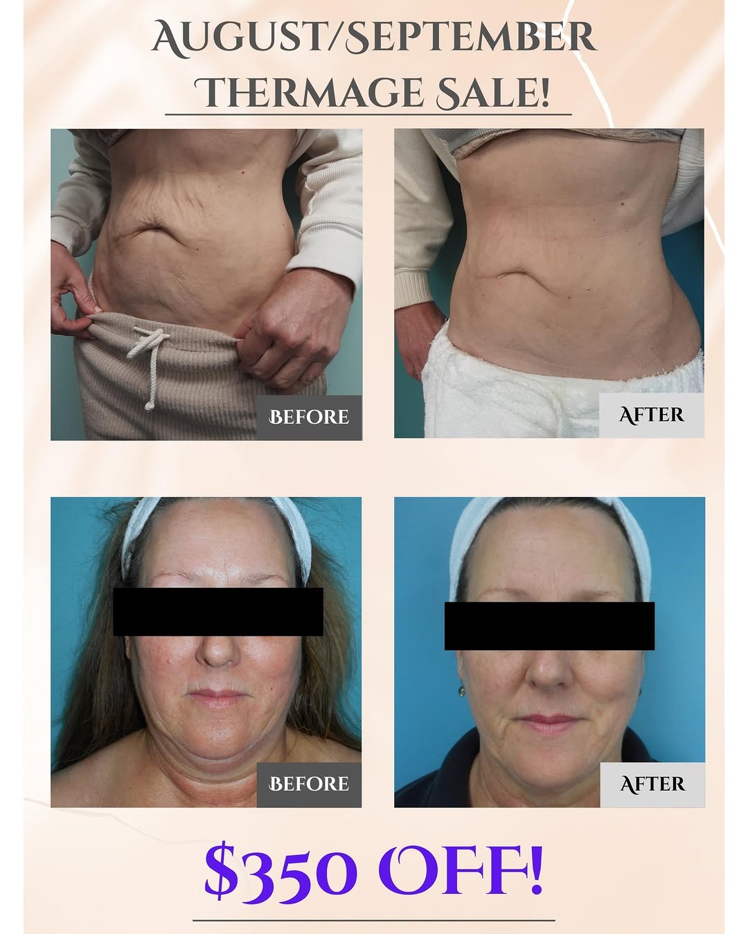 Instagram post by Dr. Christine Sciara: The results speak for themselves. If you've been thinking about tightening loose skin without surgery, now is the perfect time to schedule y…
