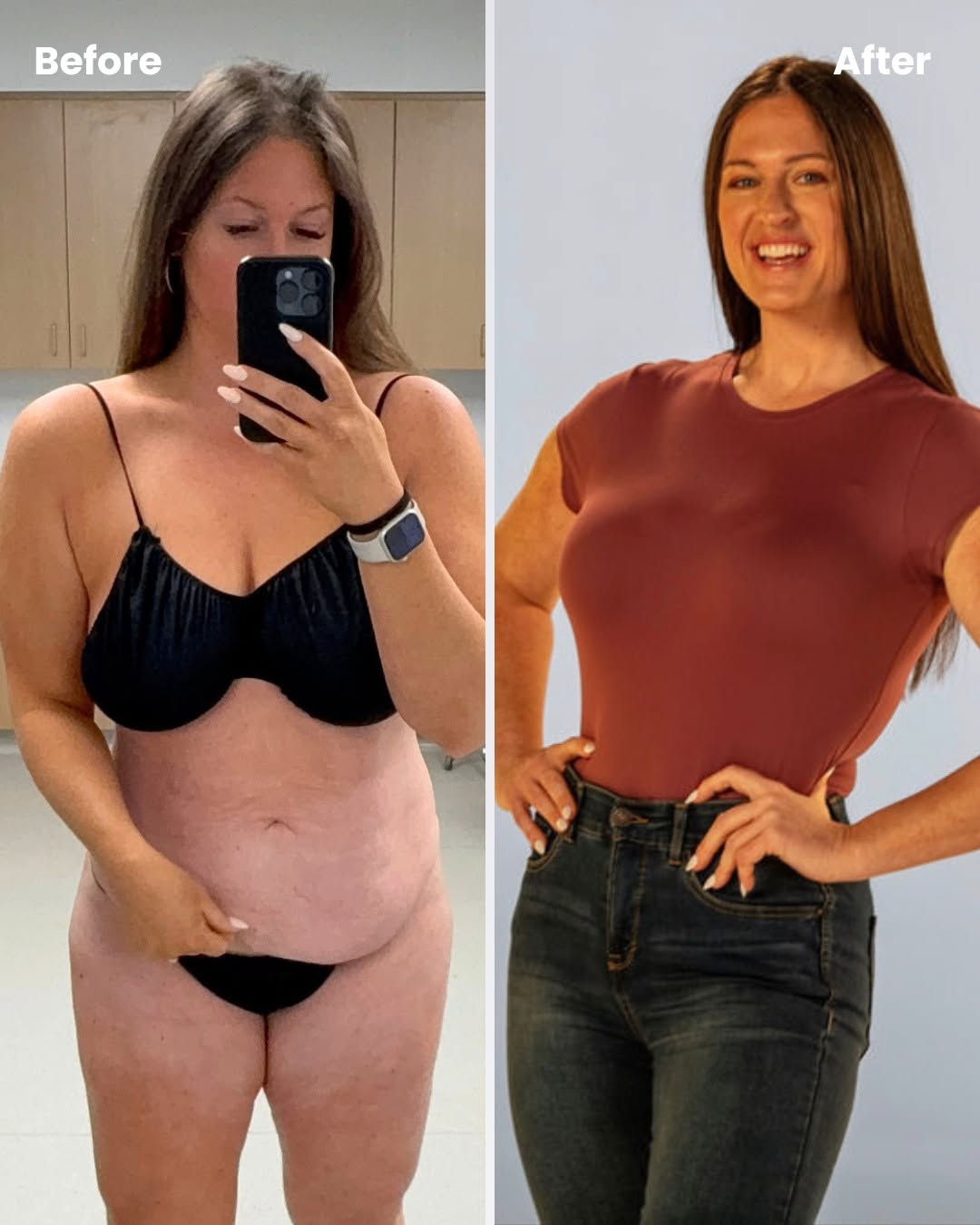 Instagram post by Dr. Christopher N. Vashi: Yesterday, Kelley shared her story. Today, see the results for yourself. ✨ After two C-sections and significant weight loss, Kelley was left…