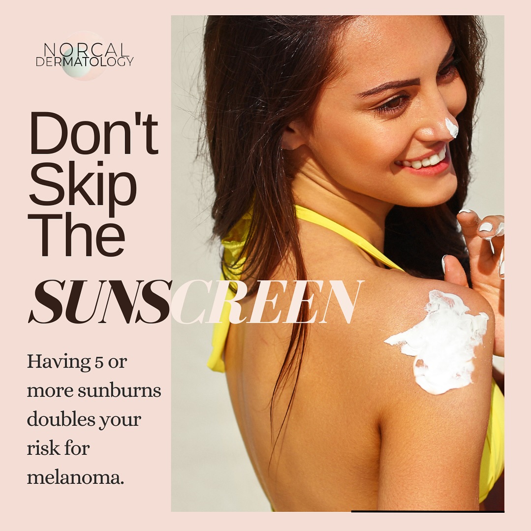 Instagram post by Dr. Clemens Esche: 🌞 Did you know that experiencing 5 or more sunburns can double your risk of melanoma? At Norcal Dermatology Group, we offer top-rated sunsc…