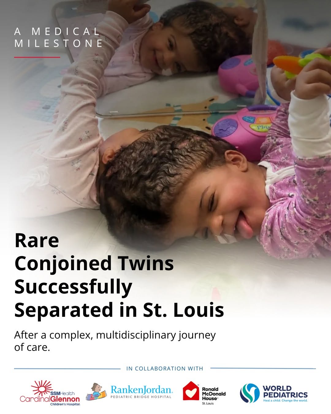 Instagram post by Dr. Clifford King: A global team led by SSM Health Cardinal Glennon Children’s Hospital in St. Louis, MO, affiliated with Saint Louis University School of Medi…