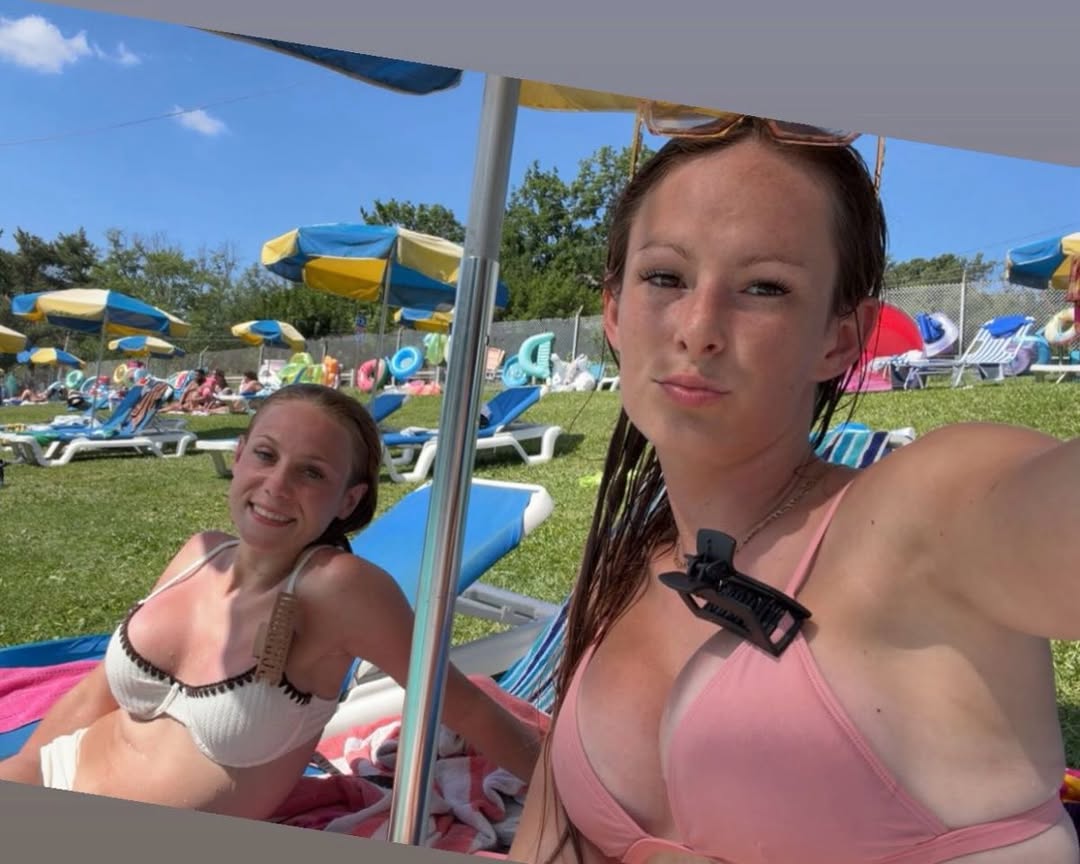Instagram post by Dr. Craig Oser, DO: Labor Day weekend may be over… but bikini confidence doesn’t have a season. 👙✨ Two girls, two breast augmentations, and absolutely ZERO reg…
