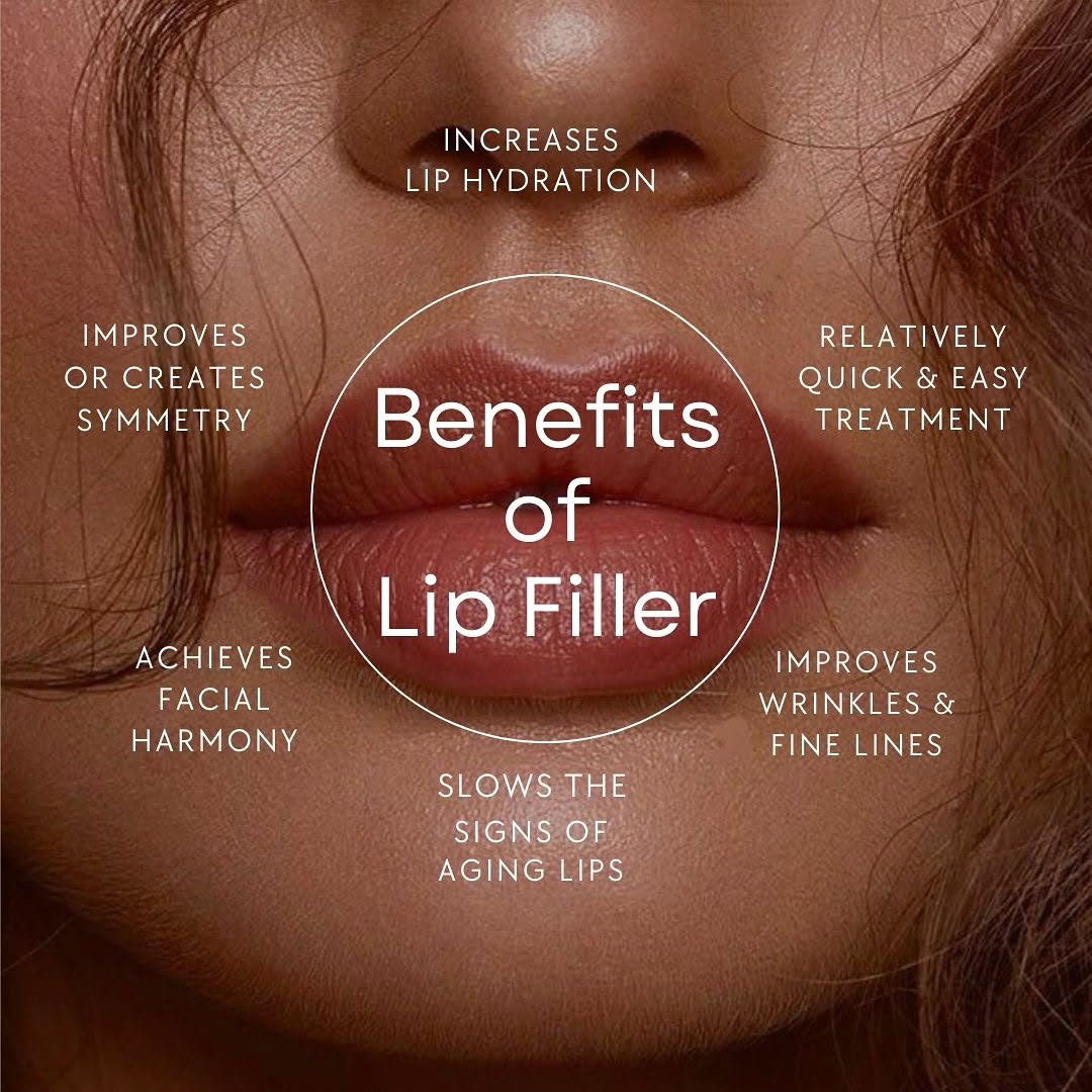 Instagram post by Dr. Cristina Dracea: 𝓑𝓮𝓷𝓮𝓯𝓲𝓽𝓼 𝓸𝓯 𝓛𝓲𝓹 𝓕𝓲𝓵𝓵𝓮𝓻𝓼 👄 Enhance your natural beauty with lip fillers that create facial harmony, boost hydration, and…
