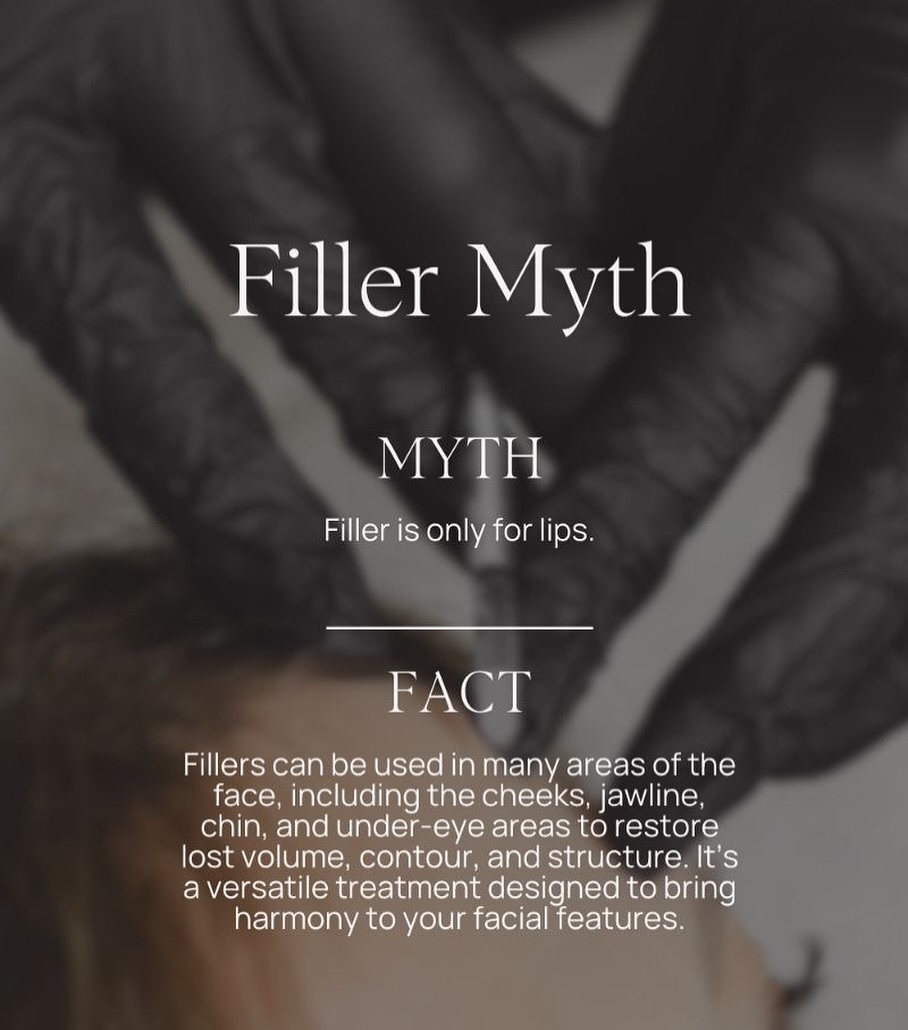Instagram post by Dr. Cristina Dracea: 𝑭𝒊𝒍𝒍𝒆𝒓: 𝑵𝒐𝒕 𝑱𝒖𝒔𝒕 𝒇𝒐𝒓 𝑳𝒊𝒑𝒔! 💉 Let’s set the record straight! “ +r Fillers can work wonders all over the face-from adding…
