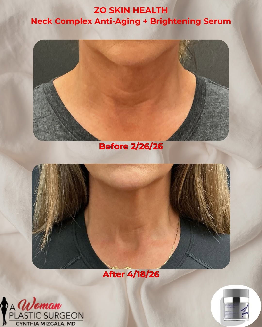 Instagram post by Dr. Cynthia L. Mizgala: Employee spotlight ✨ Michelle’s glow is not a filter… it’s consistency. Before → After 💫 Refined, lifted, and visibly brighter—powered by Z…