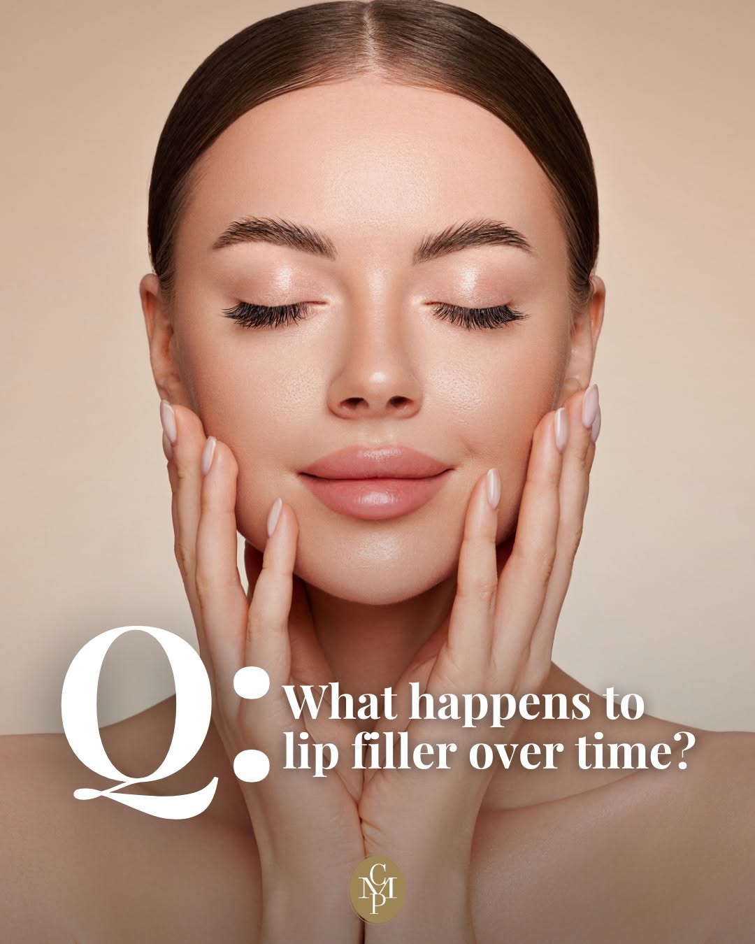 Instagram post by Dr. Cynthia M. Poulos: Let's talk filler longevity.👄✨ Hyaluronic acid fillers are naturally broken down by your body over 6–18 months, depending on the product, p…