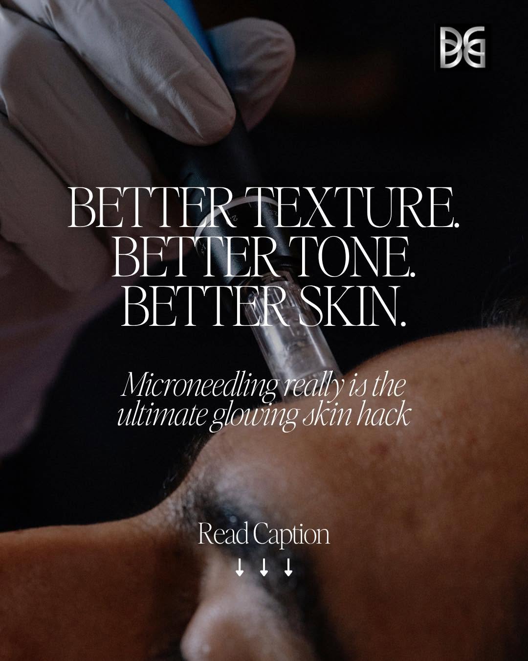 Instagram post by Dr. Dale Isaacson: Microneedling is one of those treatments that does a little bit of everything — and that’s exactly why we love it. By creating controlled mi…