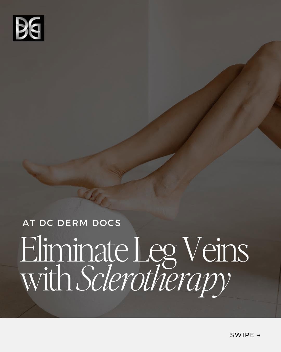 Instagram post by Dr. Dale Isaacson: Ready to say goodbye to unwanted spider and varicose veins? Sclerotherapy is a minimally invasive treatment that works by injecting a specia…