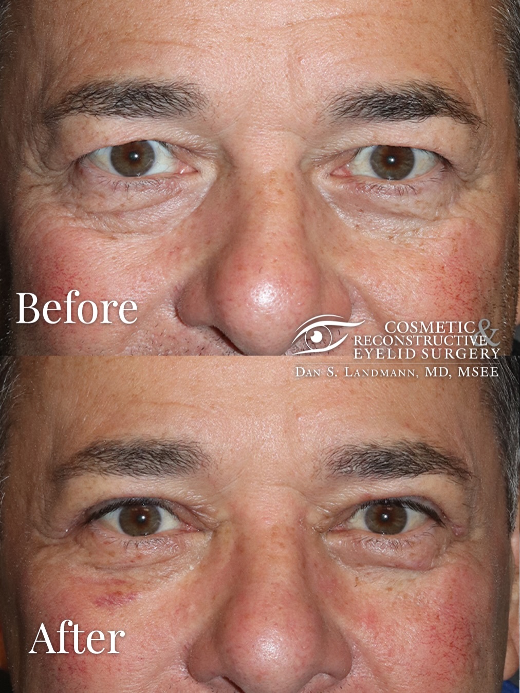 Instagram post by Dr. Dan Landmann: Most of my patients are women, but I treat a ton of men. And men have really great outcomes. Here’s a very vibrant gentleman who just had ho…