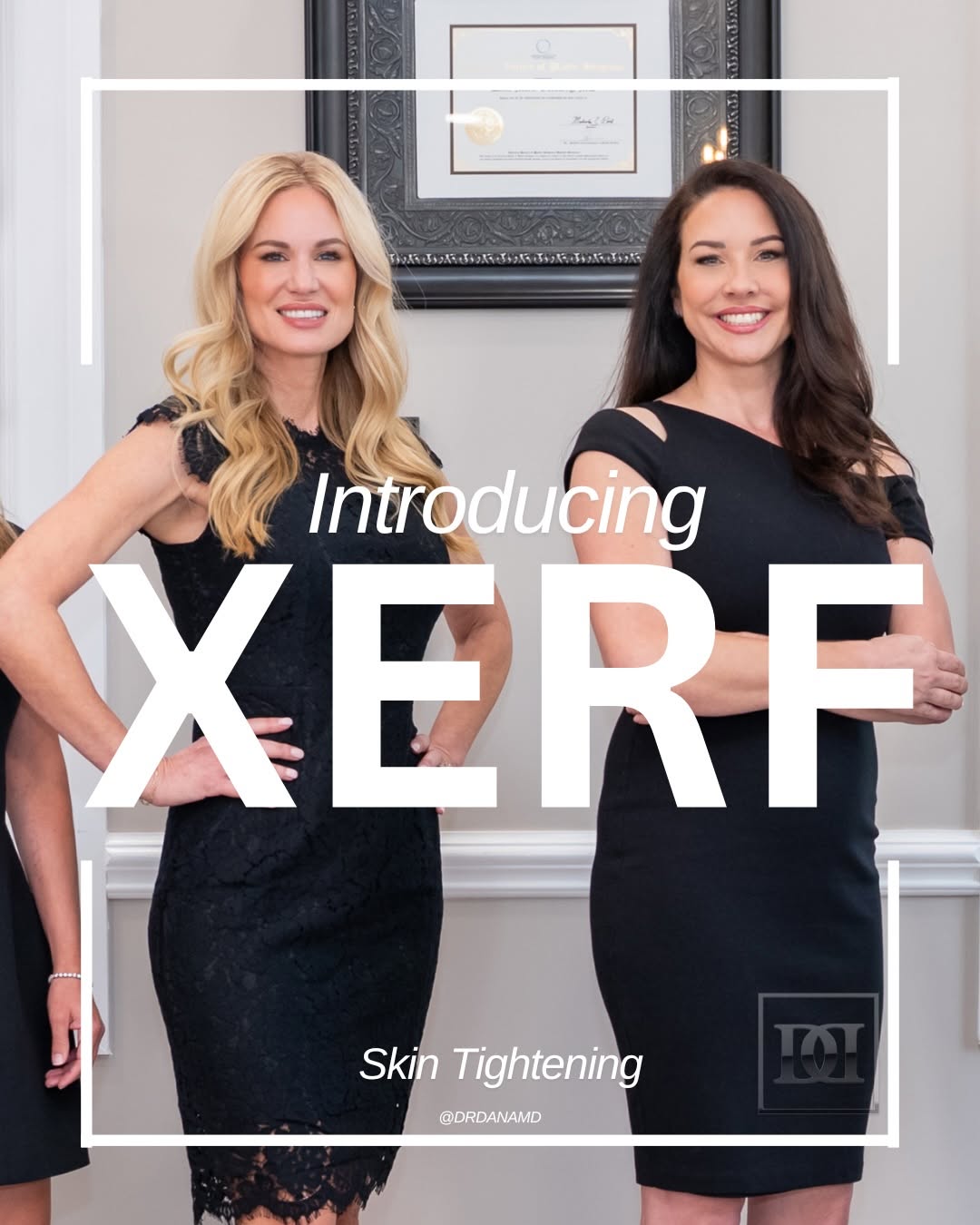 Instagram post by Dr. Dana Goldberg: ✨ The treatment everyone is asking about is finally here. ✨ XERF has taken the aesthetics world by storm — and now it’s available right here…