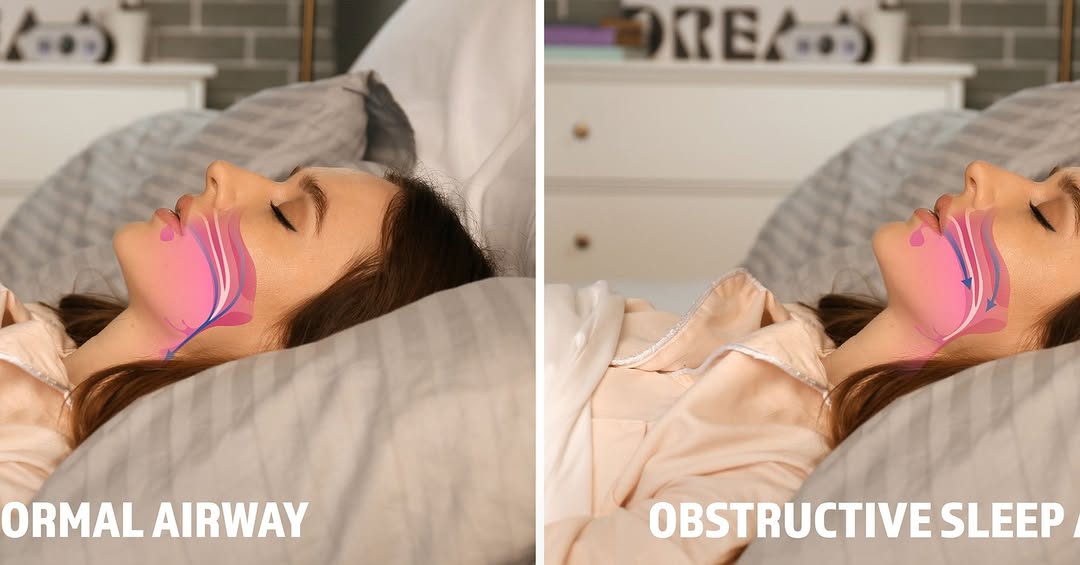 Instagram post by Dr. Daniel Daube: Snoring keeping you (or your partner 😅) up? It might be more than annoying. Sleep apnea affects your energy, focus, and long-term health. O…