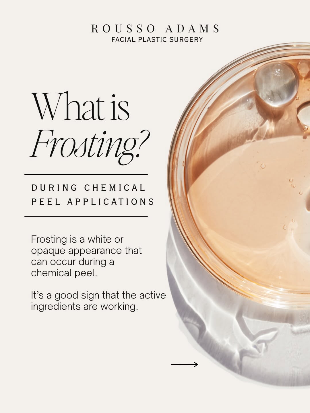 Instagram post by Dr. Daniel E. Rousso: What does “frosting” during a chemical peel actually mean? ❄️ That white appearance isn’t your skin “burning.” It’s a visible sign of the ch…
