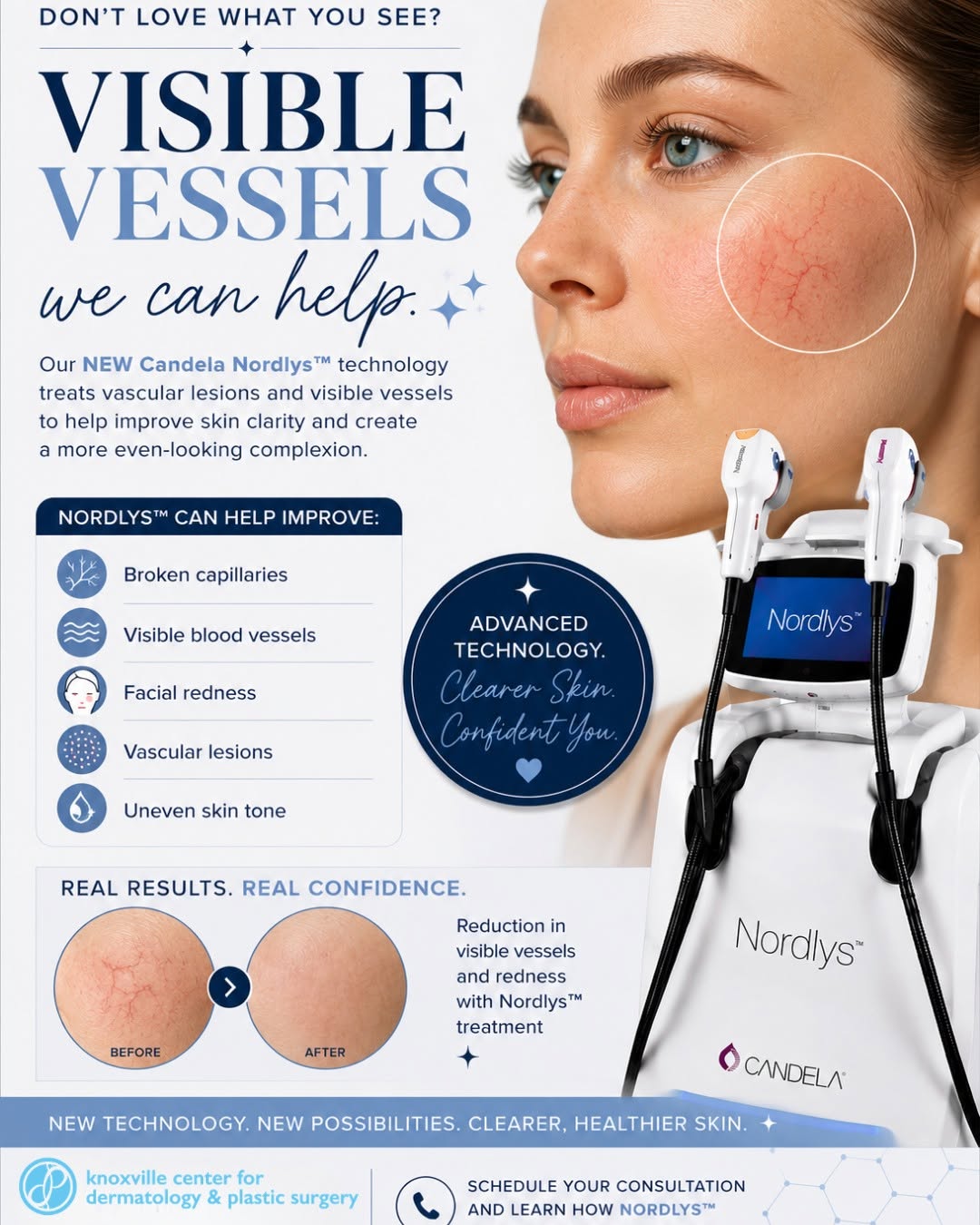 Instagram post by Dr. Daniel Fowler: ✨ SEEING LITTLE RED OR PURPLE VESSELS YOU WISH WEREN’T THERE? Broken capillaries and visible blood vessels can be stubborn — and skincare an…