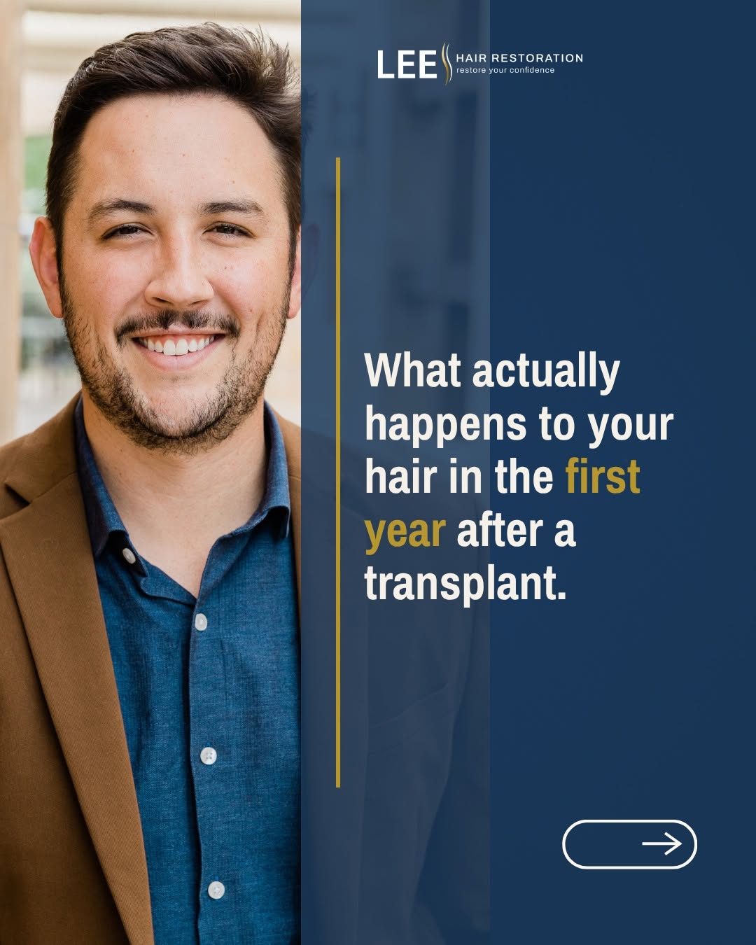 Instagram post by Dr. Daniel J. Lee: A hair transplant isn't instant, but the wait is worth it. Knowing what to expect at every stage makes the journey a lot easier to navigate.…