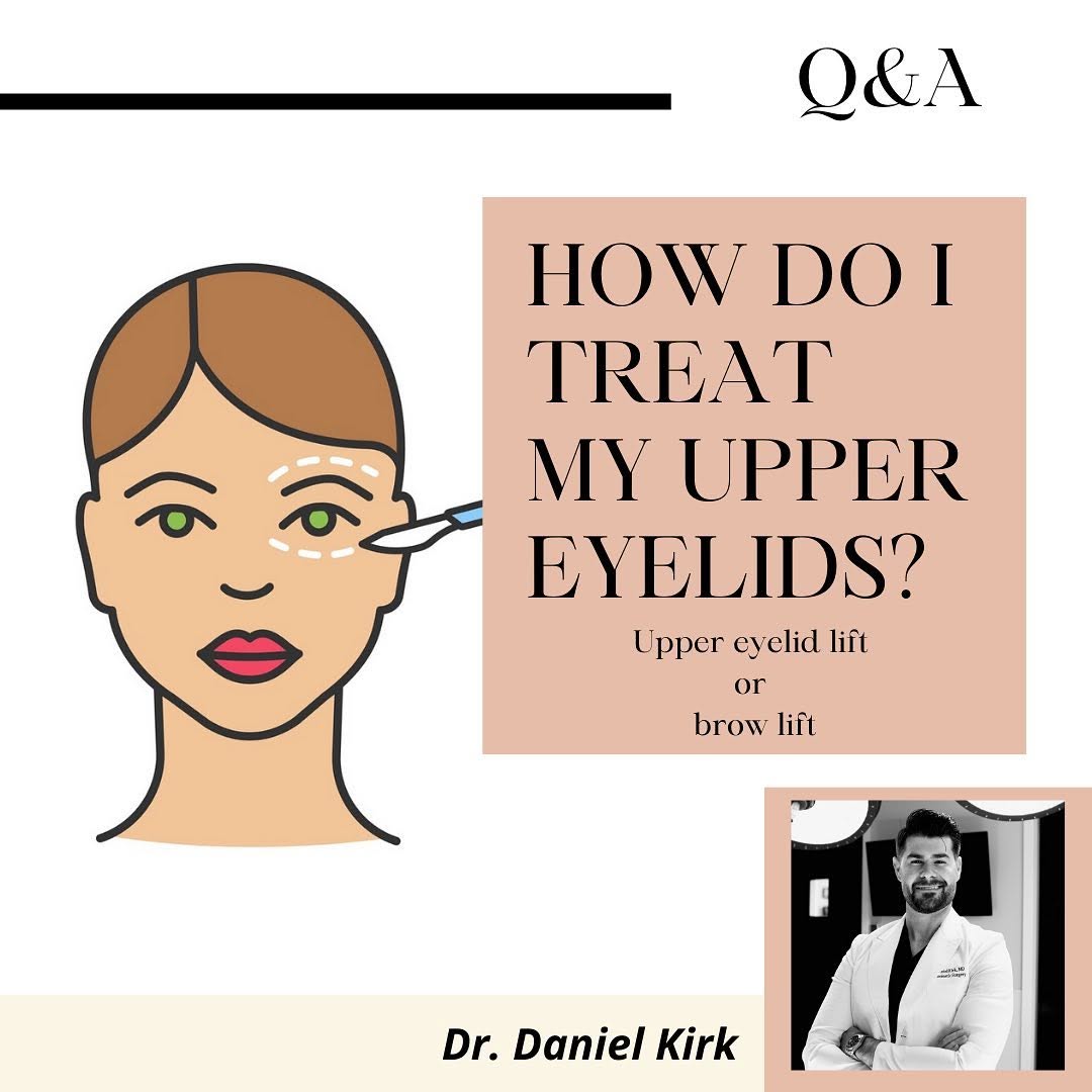 Instagram post by Dr. Daniel Kirk: Hooded eyelids? Do you need a blepharoplasty, browlift or both?! Find out here! #blepharoplasty #hoodedeyes #browlift #endoscopicbrowlift #e…