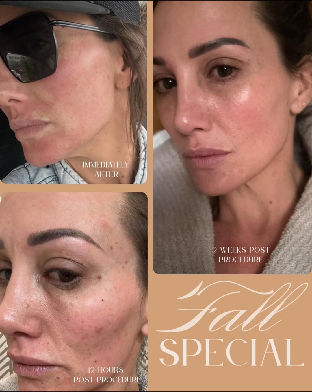 Instagram post by Dr. Daniel Thomas: ✨ Transform your skin with the power of a Photo Facial! ✨ Say goodbye to sun damage, age spots, redness from rosacea, and visible blood vess…