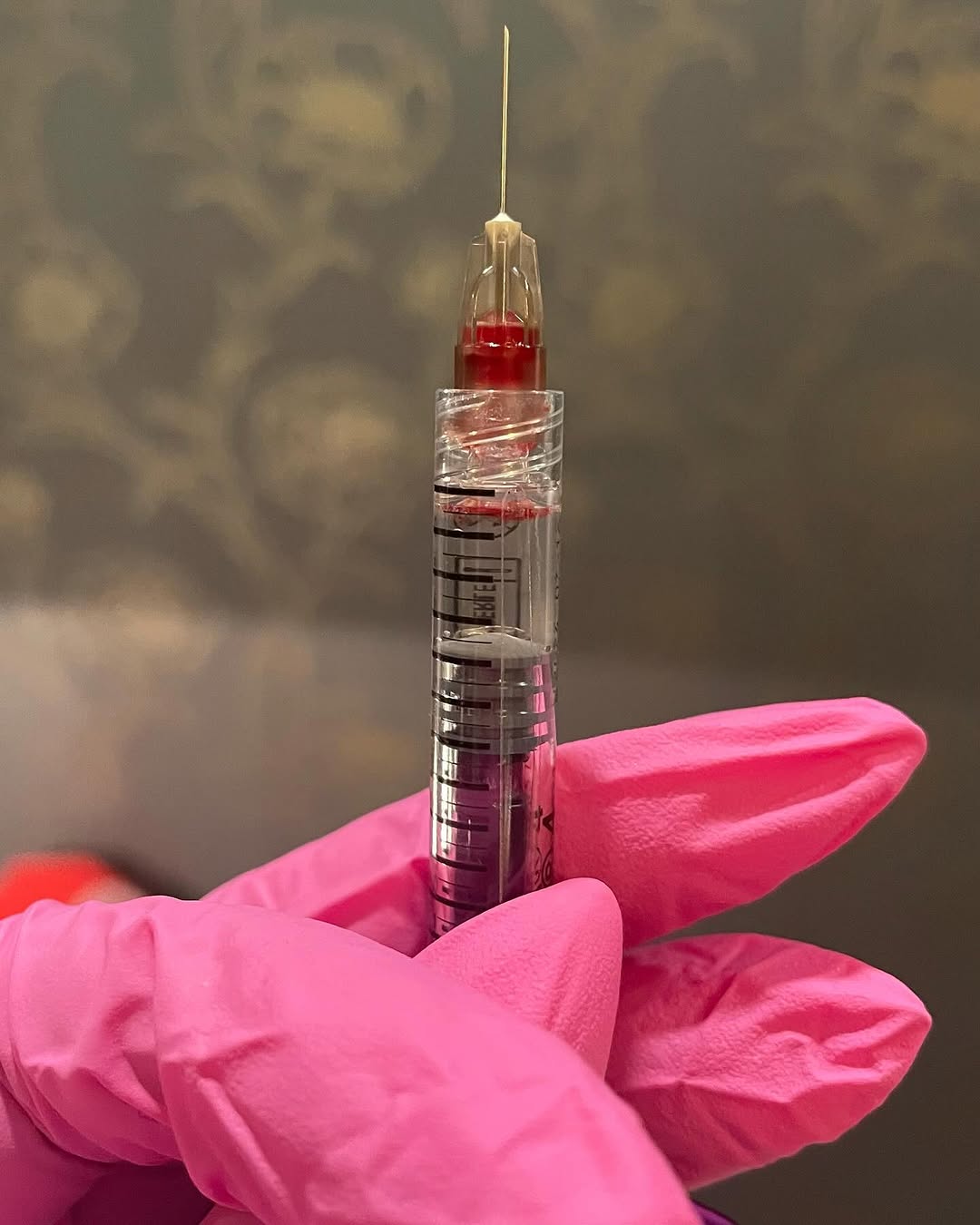 Instagram post by Dr. Darice W. Fadeyi: Filler is not a quick lunchtime procedure, despite how it may be advertised or portrayed on social media. We need sufficient time to inject …