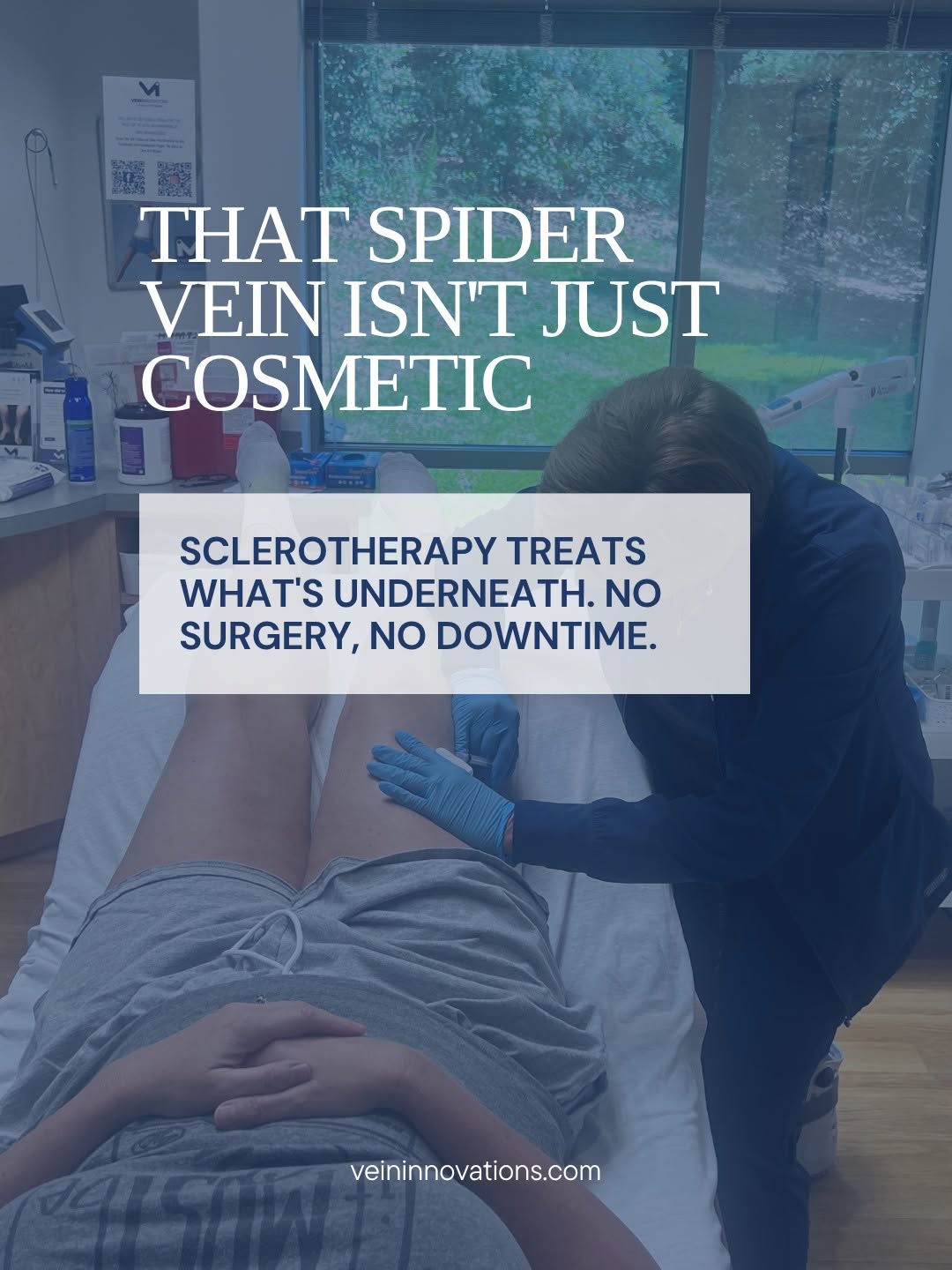 Instagram post by Dr. Darrell Caudill: Spider veins aren't just cosmetic. They're often a sign of what's happening with circulation underneath the surface. Sclerotherapy treats th…