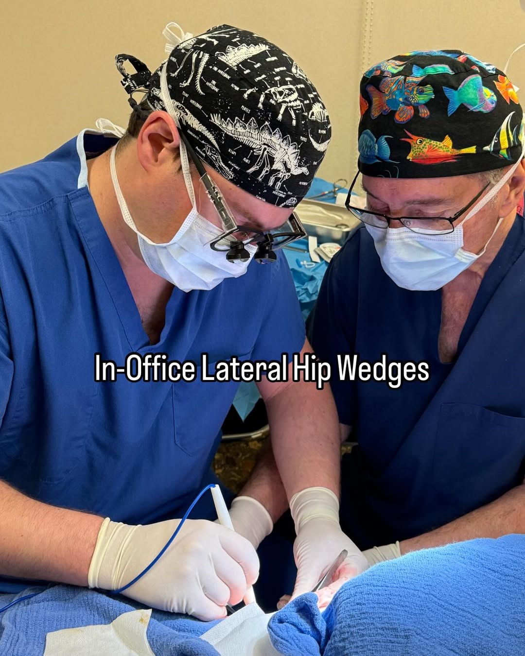 Instagram post by Dr. David Benvenuti: Happiness for the Hips — Right in the Office! Smooth your hip contour with in-office lateral hip wedges. Performed under local anesthesia wi…