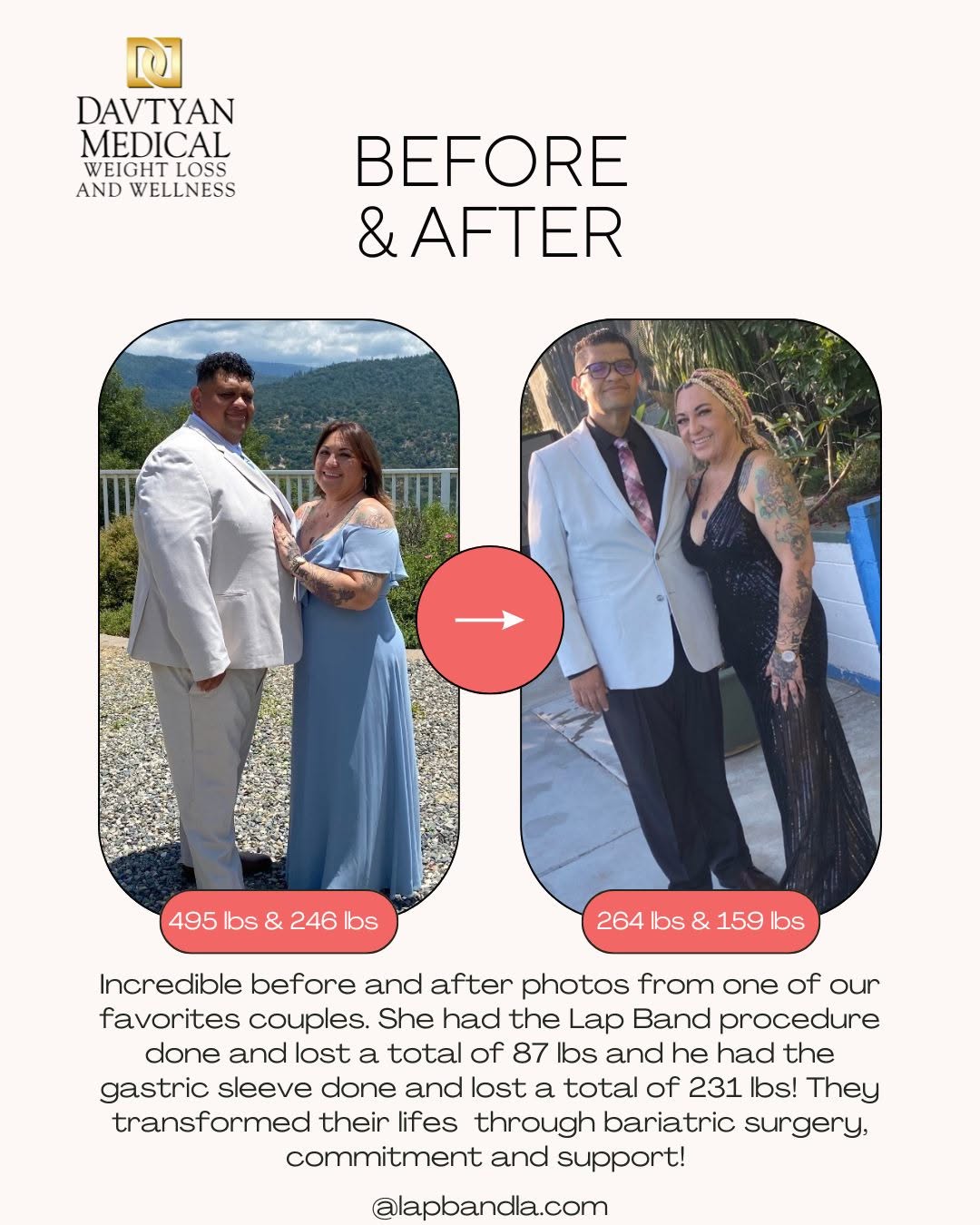 Instagram post by Dr. David G. Davtyan: Together, they lost over 318 pou#drdavtyan . This amazing couple took the journey to better health side by side — he lost 231 lbs and she lo…