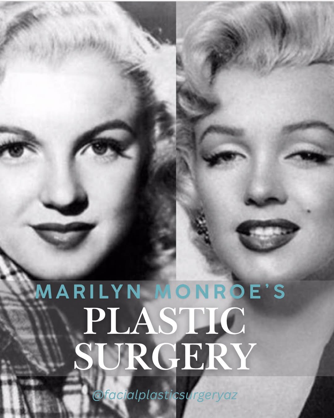 Instagram post by Dr. David Hecht: Did Marilyn Monroe get facial plastic surgery?🤔 Fans have speculated for decades about whether Marilyn Monroe’s beauty was all natural, and…