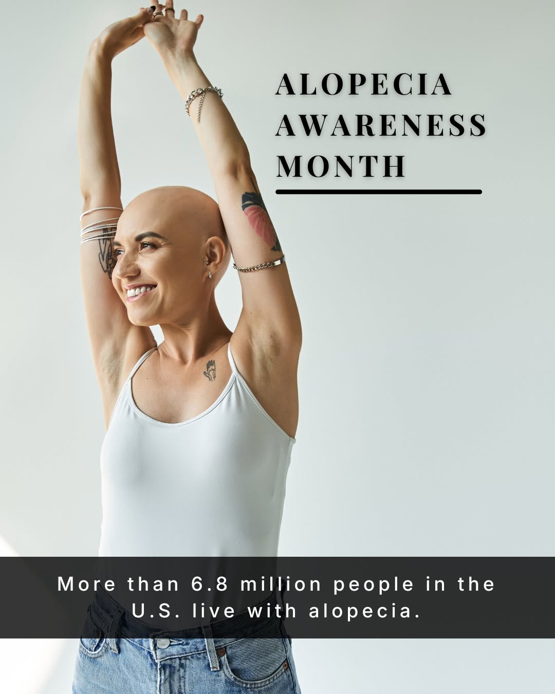 Instagram post by Dr. David J. Sire: It’s Alopecia Awareness Month 🎗️ Hair loss affects people of all ages and genders, and it’s more common than many realize. Alopecia Awarene…