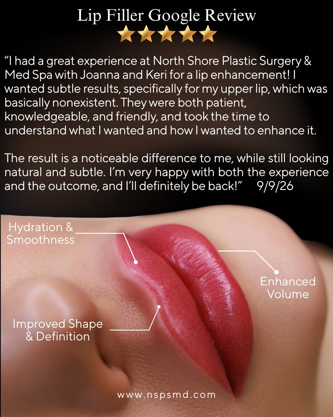 Instagram post by Dr. David J. Wages: Our Nurse Injectors are THE BEST! Known for their precision, advanced injecting techniques and giving patients beautiful results. #lipfiller…