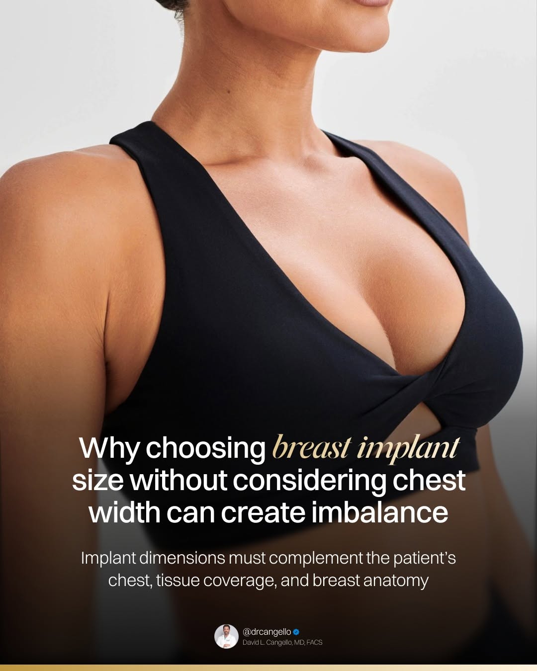 Instagram post by Dr. David L. Cangello: Breast implant selection should never be based on volume alone. Two implants with the same number of cubic centimeters can have very differe…