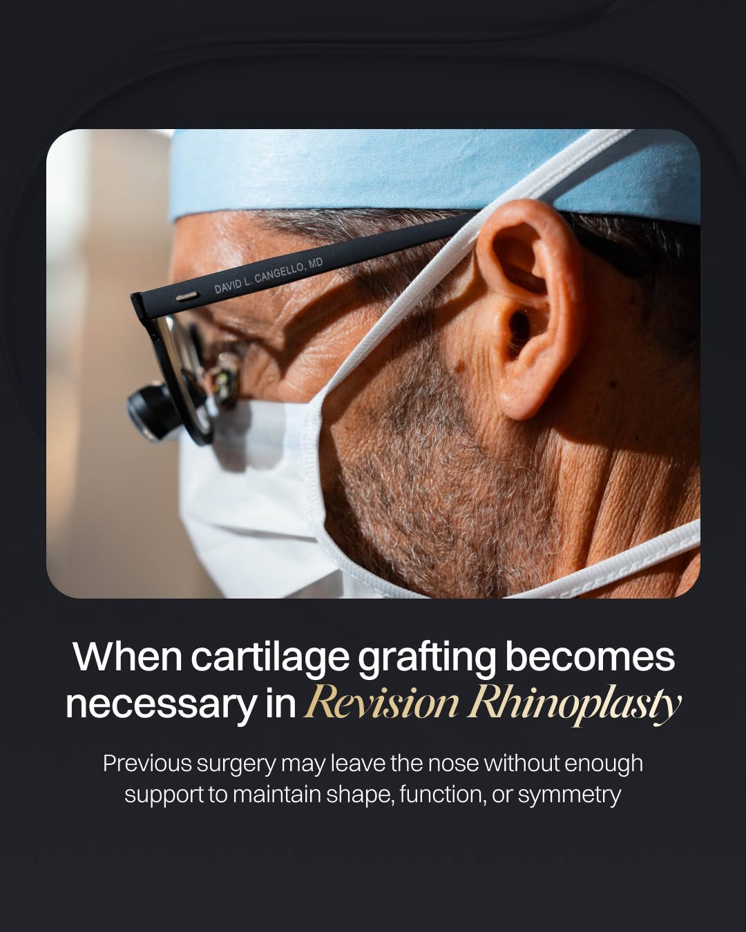 Instagram post by Dr. David L. Cangello: Revision Rhinoplasty often involves more than refining the appearance of the nose. Previous surgery may have removed, weakened, or altered c…