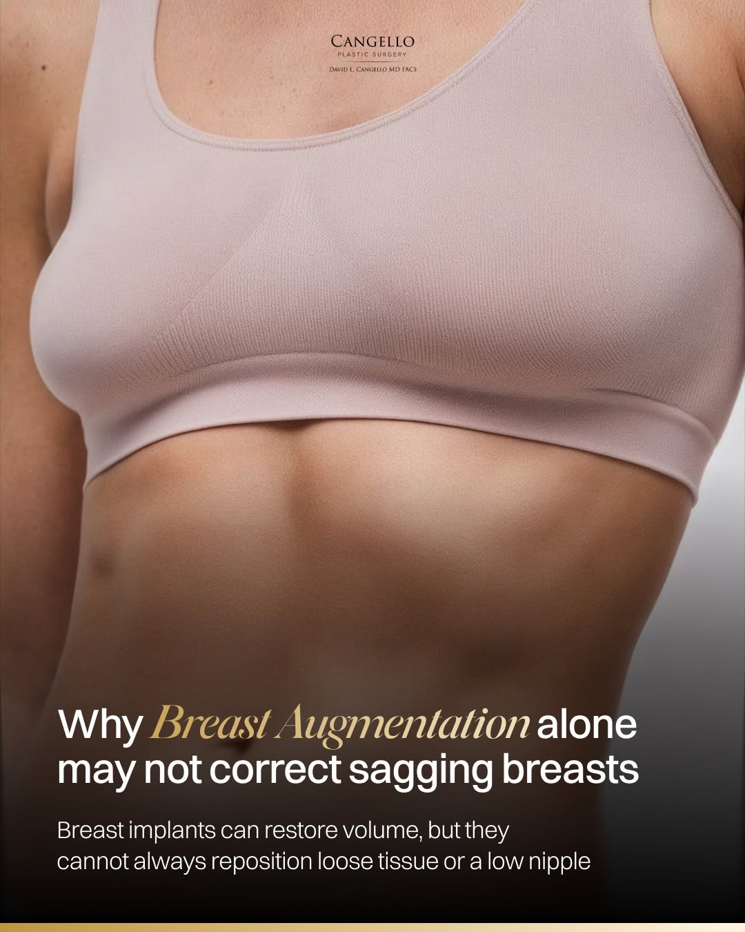 Instagram post by Dr. David L. Cangello: Some patients with sagging breasts believe that adding an implant will lift the breast and restore a more youthful position. An implant can …