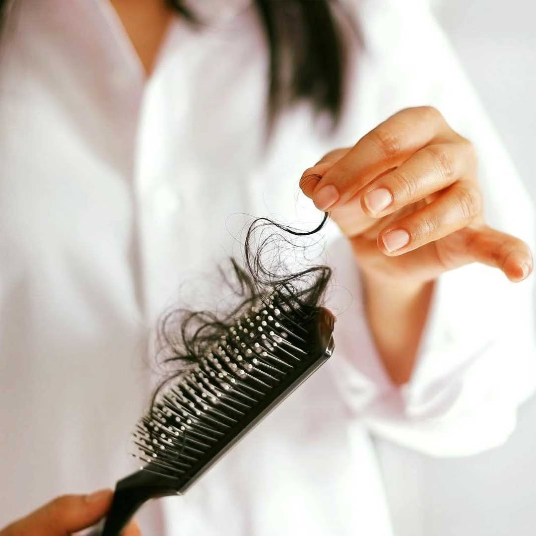 Instagram post by Dr. David P. Melamed: Postpartum Hair Loss is Real! https://www.westlaskincare.com/1129-2/