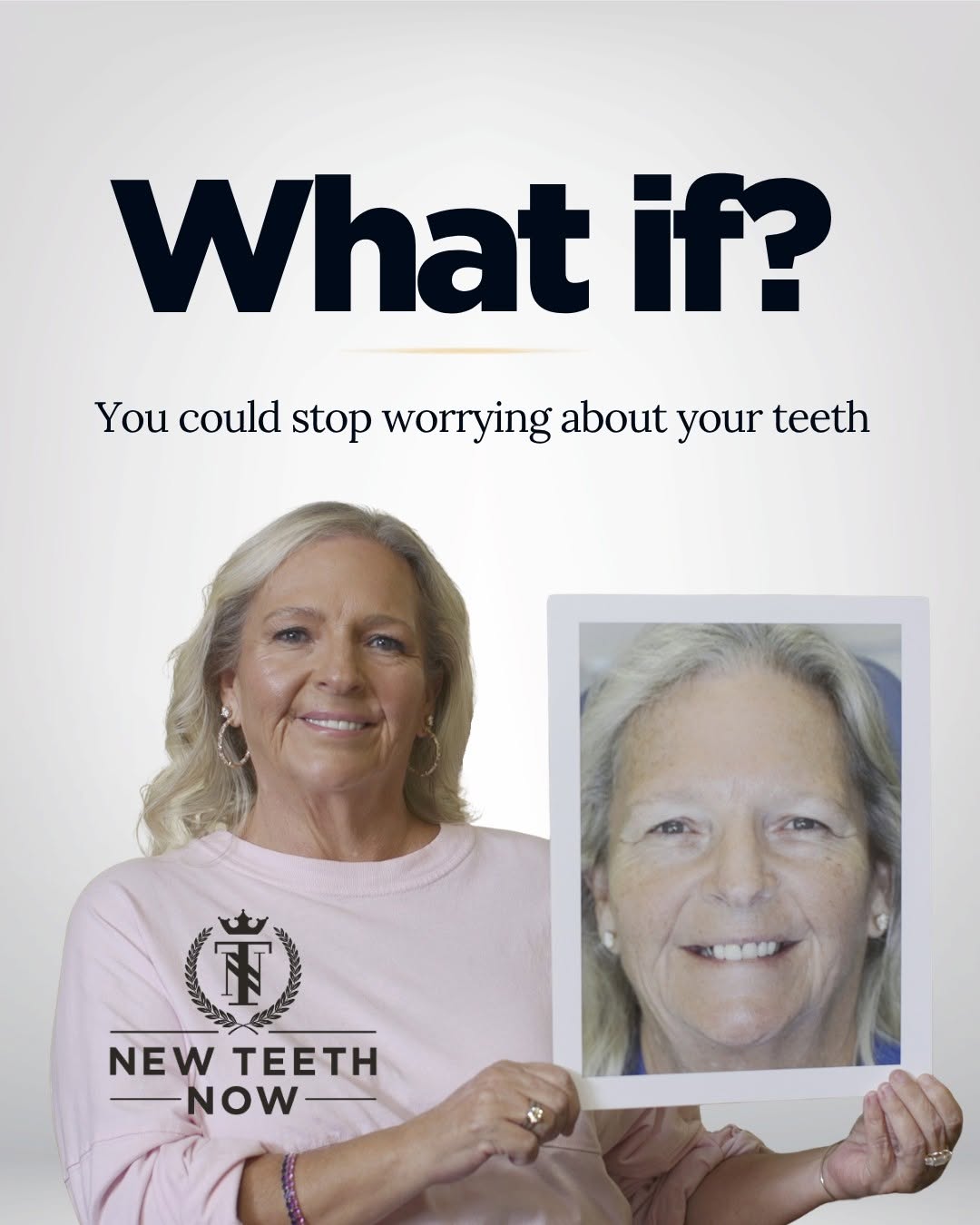 Instagram post by Dr. David R. Kirkpatrick, D: What if you could stop worrying about your teeth? If you’re dealing with failing or broken teeth, struggling with dental work that doesn’t l…