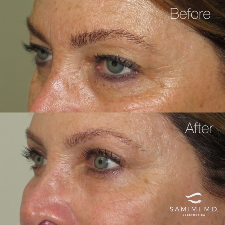 Instagram post by Dr. David Samimi: A before and after that reflects years of trust. This patient first found me through word of mouth, and over time we have worked together th…