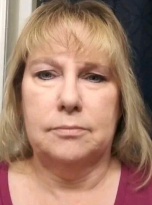 Instagram post by Dr. Dean P. Kane: Facelift-like results from non-surgical procedures are completely achievable. With a skill and a tailored combination of techniques and proc…