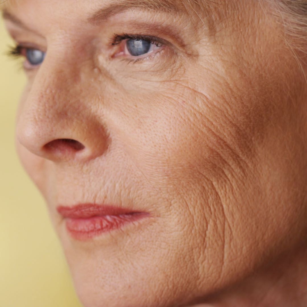 Instagram post by Dr. Deborah Sillins: Wrinkles are caused by a combination of factors — some you can control, others you can't. Age, exposure to ultraviolet light, smoking and re…