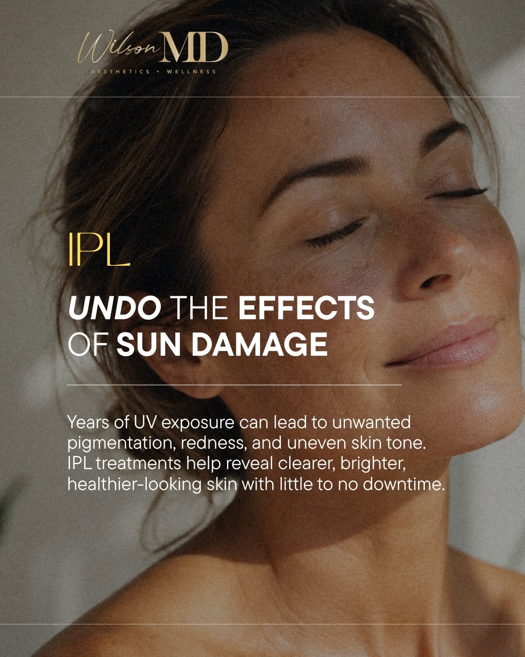 Instagram post by Dr. Deborah Wilson: Sun damage doesn't happen overnight, and neither does healthy, radiant skin. But with the right treatment, you can visibly improve years of …