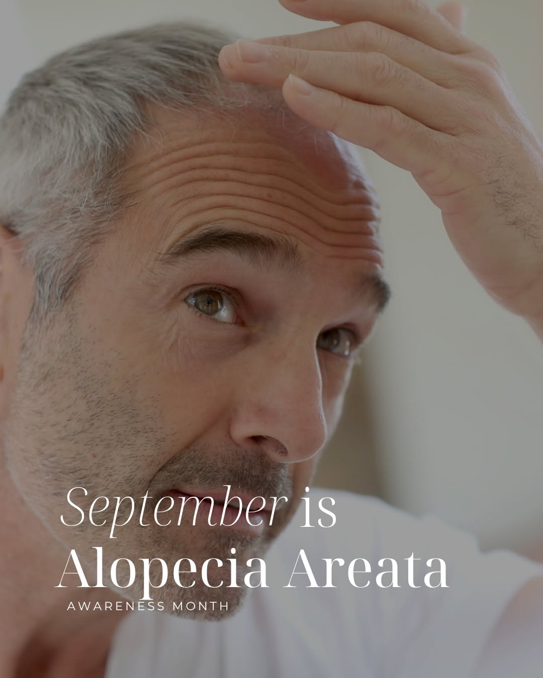 Instagram post by Dr. Debra Babich: September marks Alopecia Areata Awareness Month! 🎗️ This month is dedicated to celebrating and acknowledging those impacted by alopecia are…