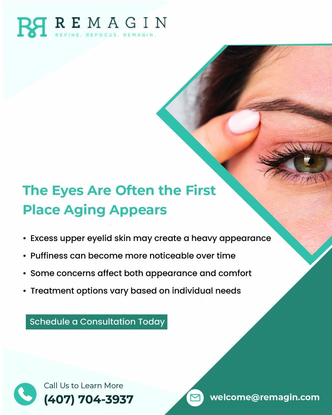 Instagram post by Dr. Deepak Raja: Changes around the eyes can occur gradually with age, including excess skin, puffiness, and a tired or heavy appearance. At Remagin, eyelid …